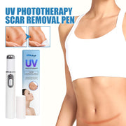 UV Light Scar Pen Gentle Fade Repair Skin Scar Smooth Skin Light Scar Pen