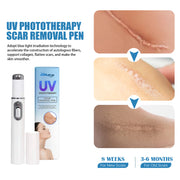 UV Light Scar Pen Gentle Fade Repair Skin Scar Smooth Skin Light Scar Pen