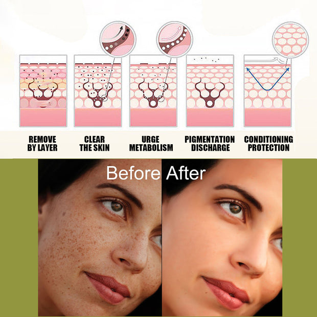 Fade Spot Repair Skin Dull Whitening Skin Lightening Cream